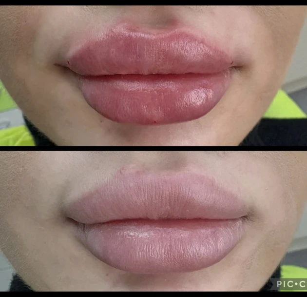 поставяне на филър - Reservation.Studio