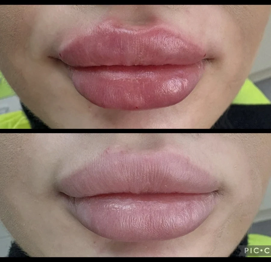 поставяне на филър - Reservation.Studio