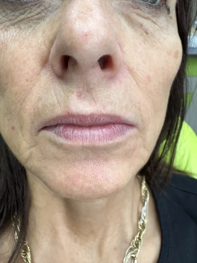 поставяне на филър - Reservation.Studio поставяне на филър - Reservation.Studio