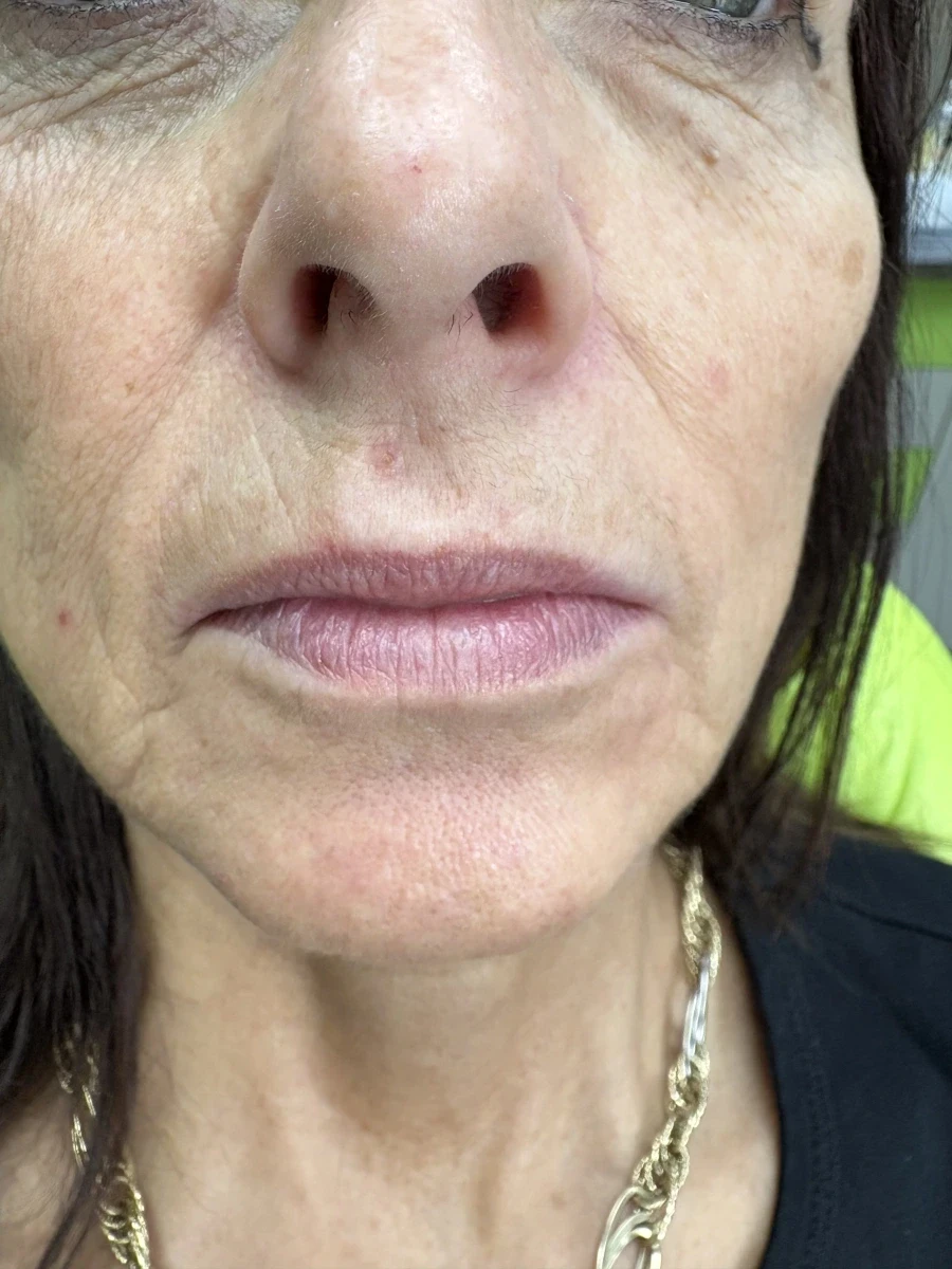 поставяне на филър - Reservation.Studio поставяне на филър - Reservation.Studio