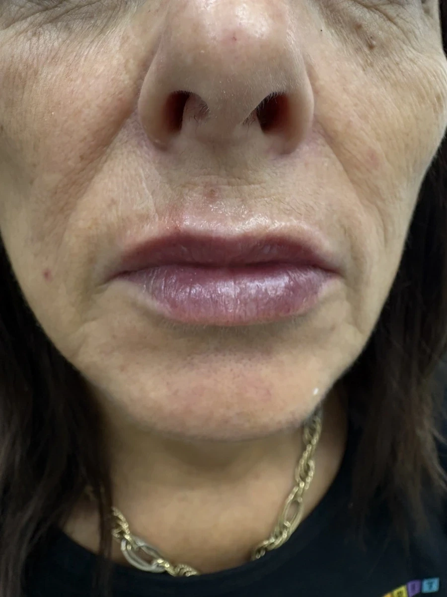 поставяне на филър - Reservation.Studio поставяне на филър - Reservation.Studio