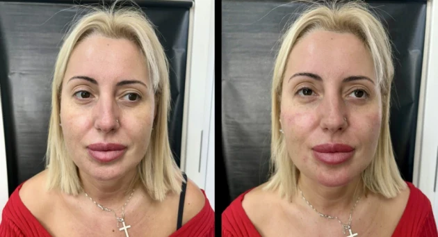 поставяне на филър - Reservation.Studio