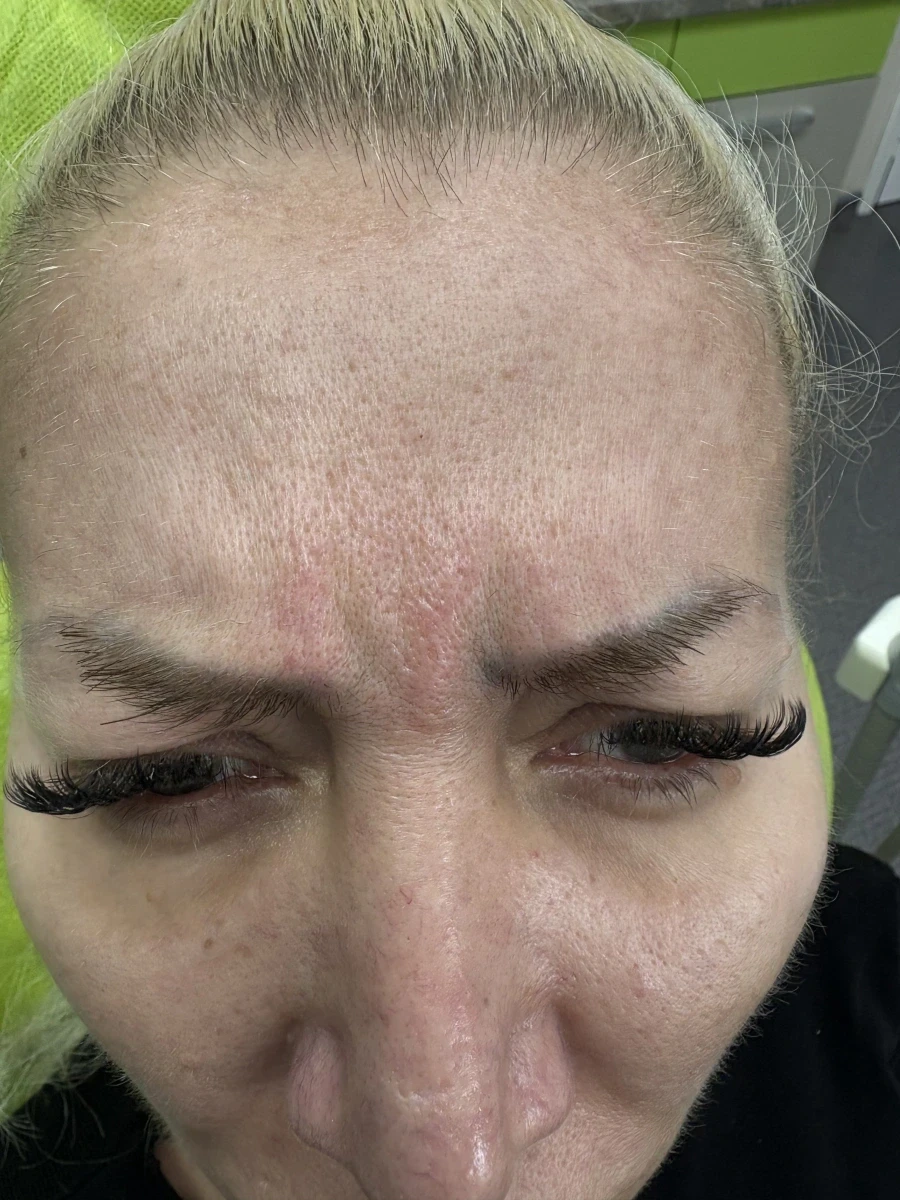 поставяне на ботокс - Reservation.Studio поставяне на ботокс - Reservation.Studio