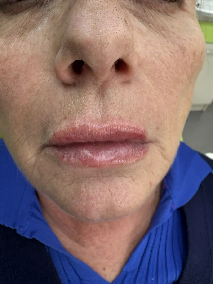 поставяне на филър - Reservation.Studio поставяне на филър - Reservation.Studio