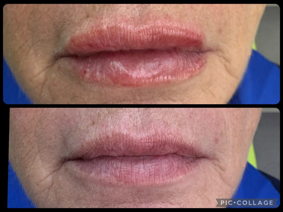 поставяне на филър - Reservation.Studio поставяне на филър - Reservation.Studio