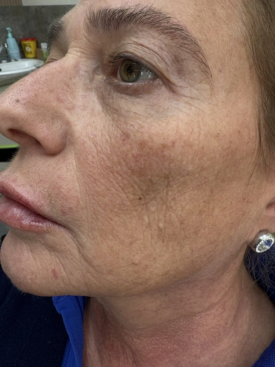 поставяне на филър - Reservation.Studio