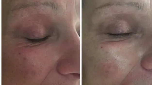 Рефреш Рефреш