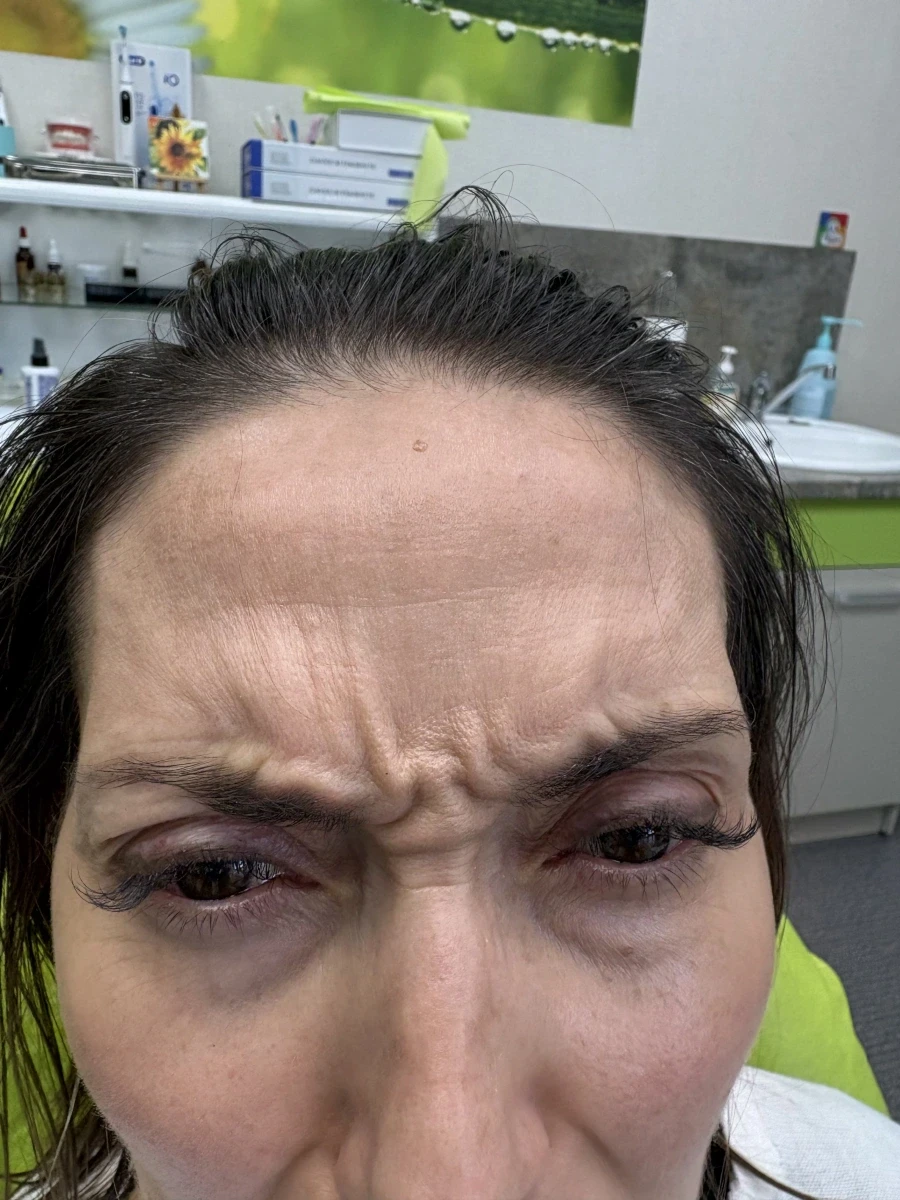 поставяне на ботокс - Reservation.Studio поставяне на ботокс - Reservation.Studio