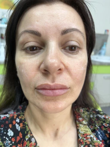 поставяне на филър поставяне на филър