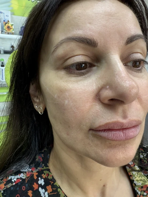 поставяне на филър - Reservation.Studio поставяне на филър - Reservation.Studio