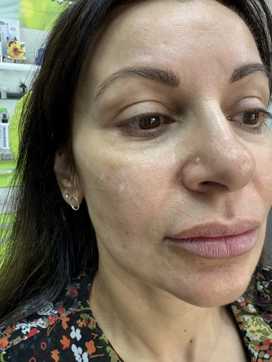 поставяне на филър - Reservation.Studio поставяне на филър - Reservation.Studio