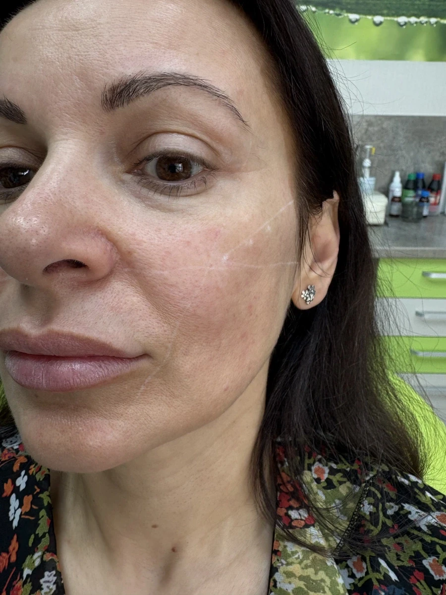 поставяне на филър - Reservation.Studio