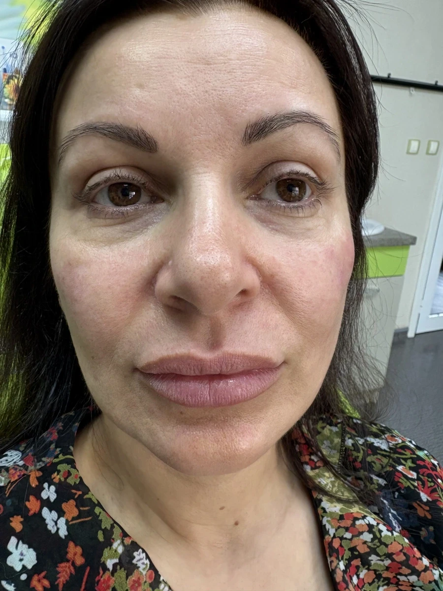 поставяне на филър - Reservation.Studio поставяне на филър - Reservation.Studio