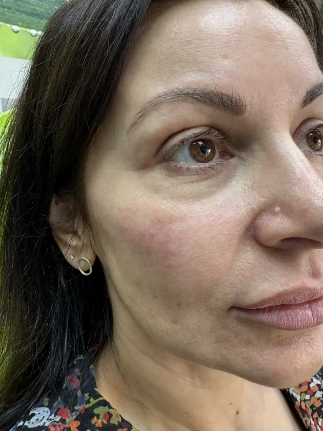 поставяне на филър - Reservation.Studio