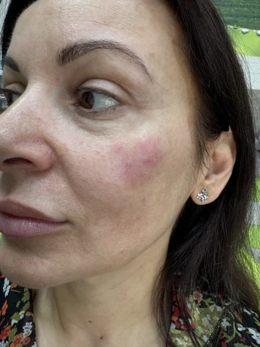 поставяне на филър