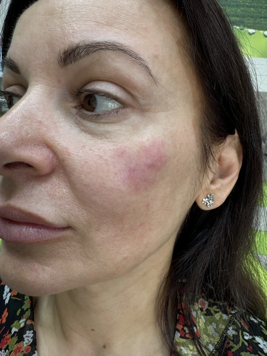 поставяне на филър - Reservation.Studio поставяне на филър - Reservation.Studio