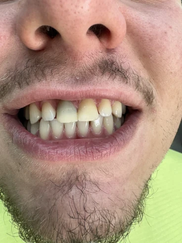 отпечатък за мост