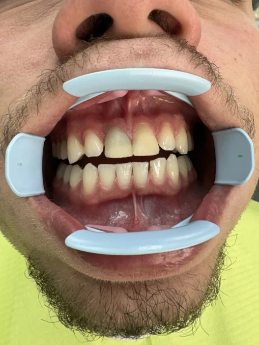 отпечатък за мост