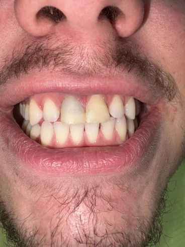 отпечатък за мост