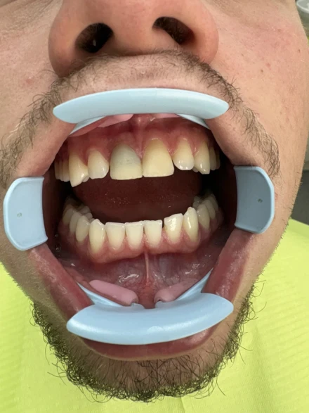 отпечатък за мост