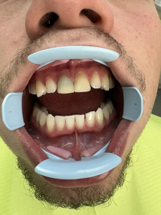 отпечатък за мост - Reservation.Studio отпечатък за мост - Reservation.Studio