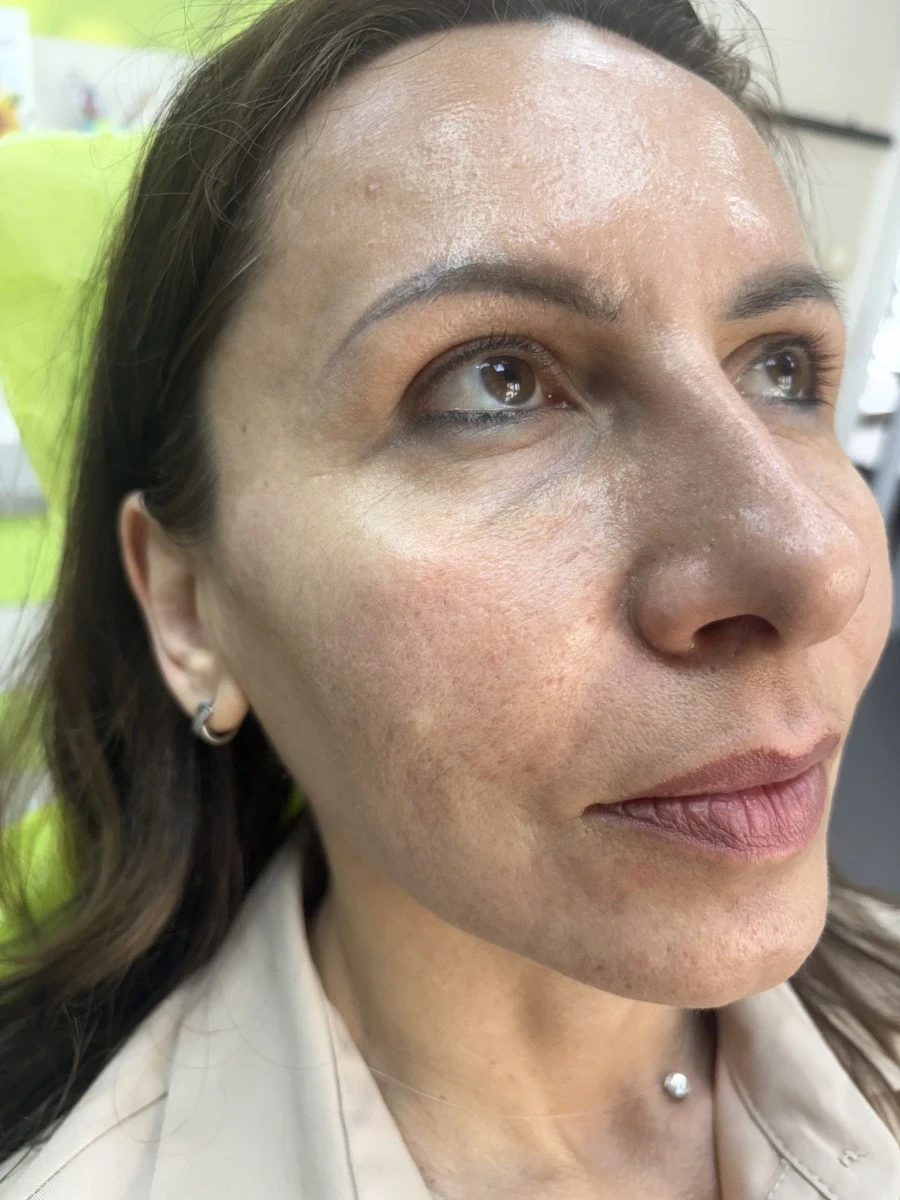 поставяне на филър - Reservation.Studio поставяне на филър - Reservation.Studio