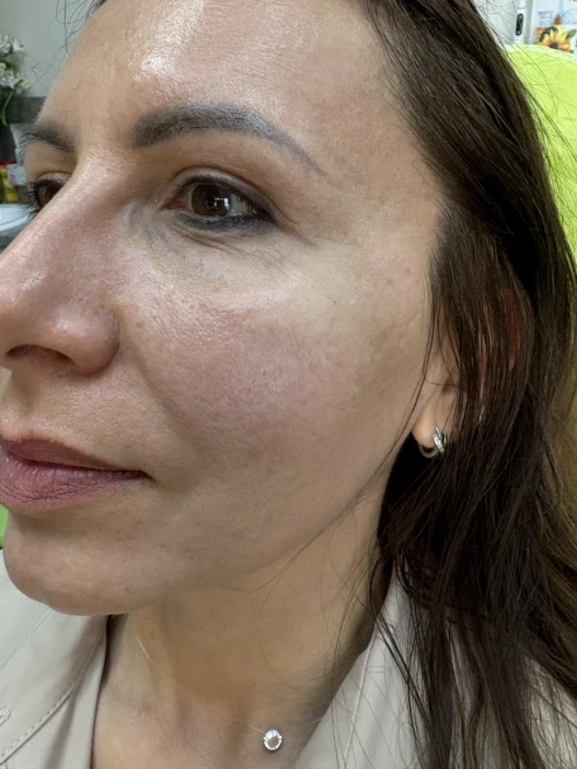 поставяне на филър поставяне на филър