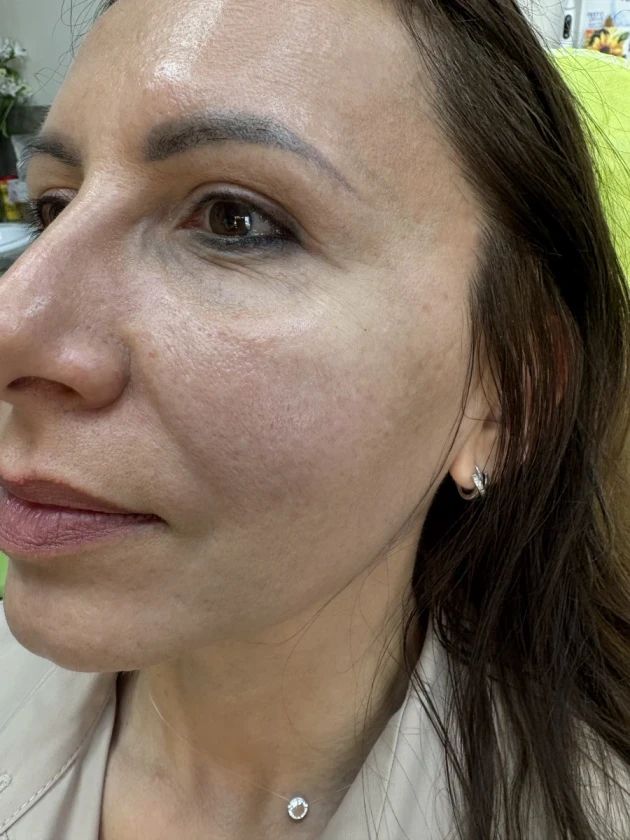 поставяне на филър - Reservation.Studio