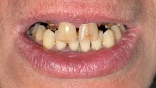 други други