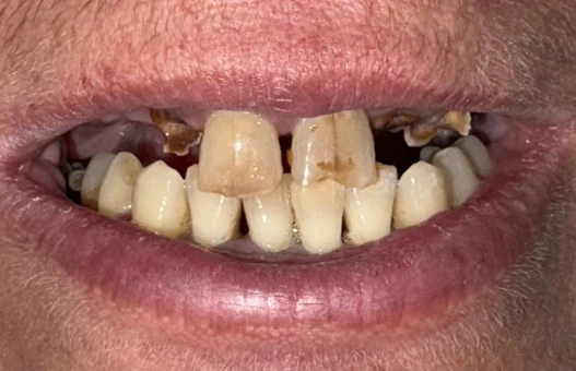 други други