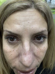 други други