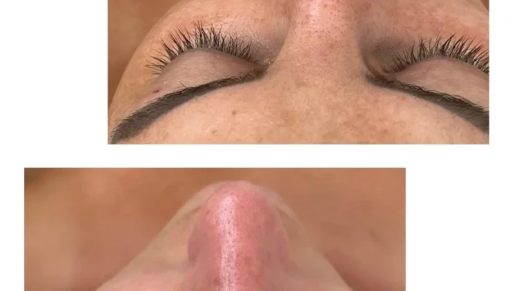 Почистване на лице с Forlle`d