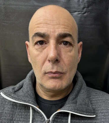 отпечатък за алайнери отпечатък за алайнери