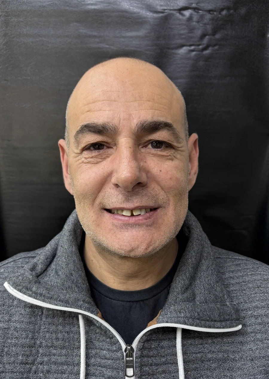 отпечатък за алайнери - Reservation.Studio отпечатък за алайнери - Reservation.Studio