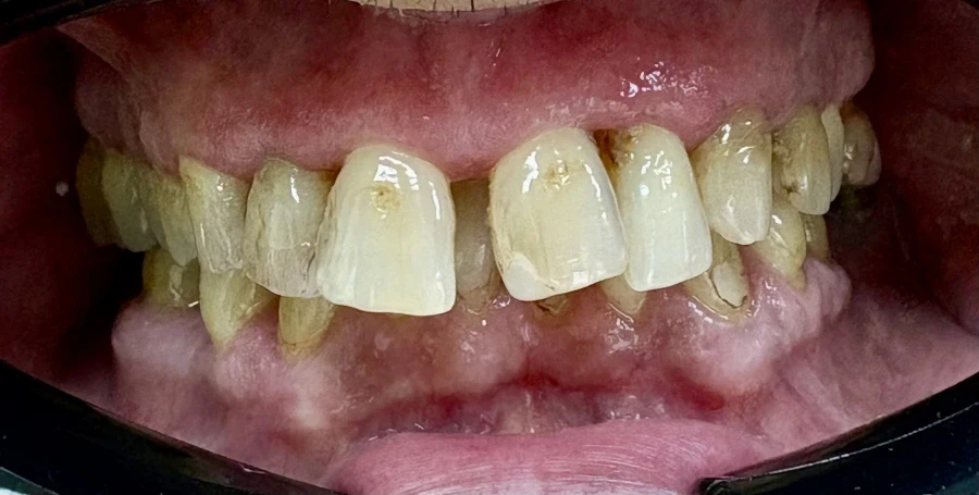 отпечатък за алайнери - Reservation.Studio отпечатък за алайнери - Reservation.Studio