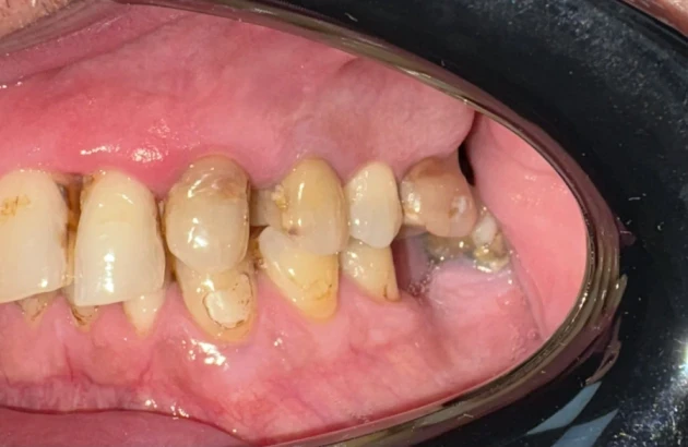 отпечатък за алайнери - Reservation.Studio отпечатък за алайнери - Reservation.Studio