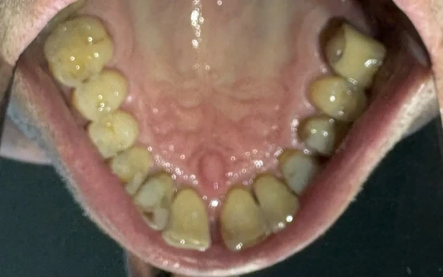 отпечатък за алайнери - Reservation.Studio отпечатък за алайнери - Reservation.Studio