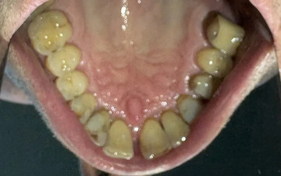 отпечатък за алайнери - Reservation.Studio