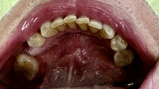 отпечатък за алайнери - Reservation.Studio отпечатък за алайнери - Reservation.Studio