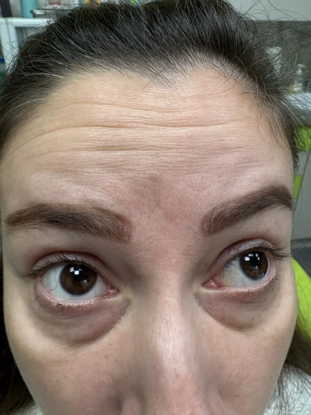 поставяне на ботокс - Reservation.Studio поставяне на ботокс - Reservation.Studio