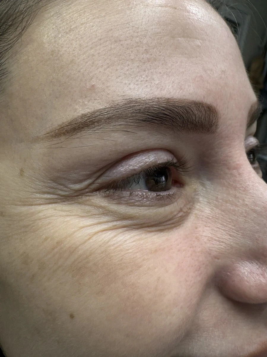 поставяне на ботокс - Reservation.Studio поставяне на ботокс - Reservation.Studio