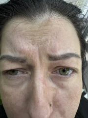 поставяне на филър