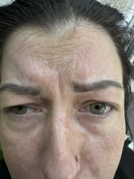 поставяне на филър поставяне на филър