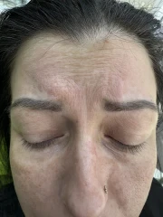 поставяне на филър