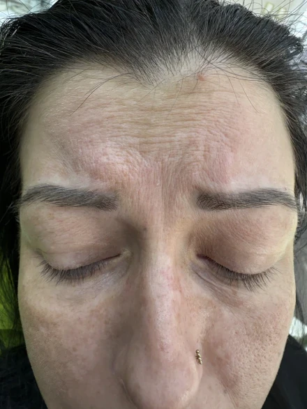 поставяне на филър