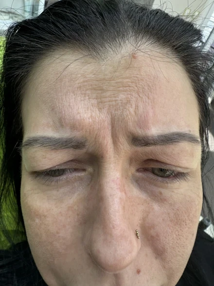 поставяне на филър