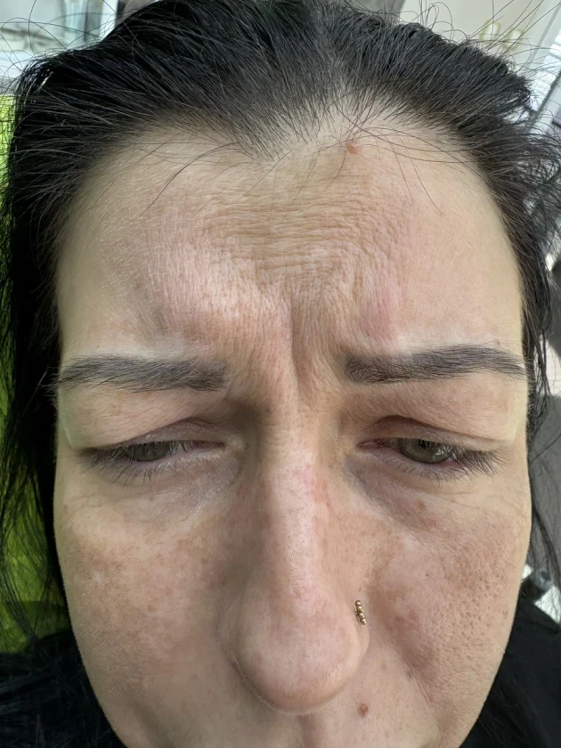 поставяне на филър - Reservation.Studio поставяне на филър - Reservation.Studio