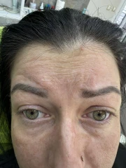 поставяне на филър