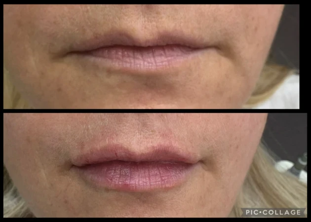 поставяне на филър - Reservation.Studio