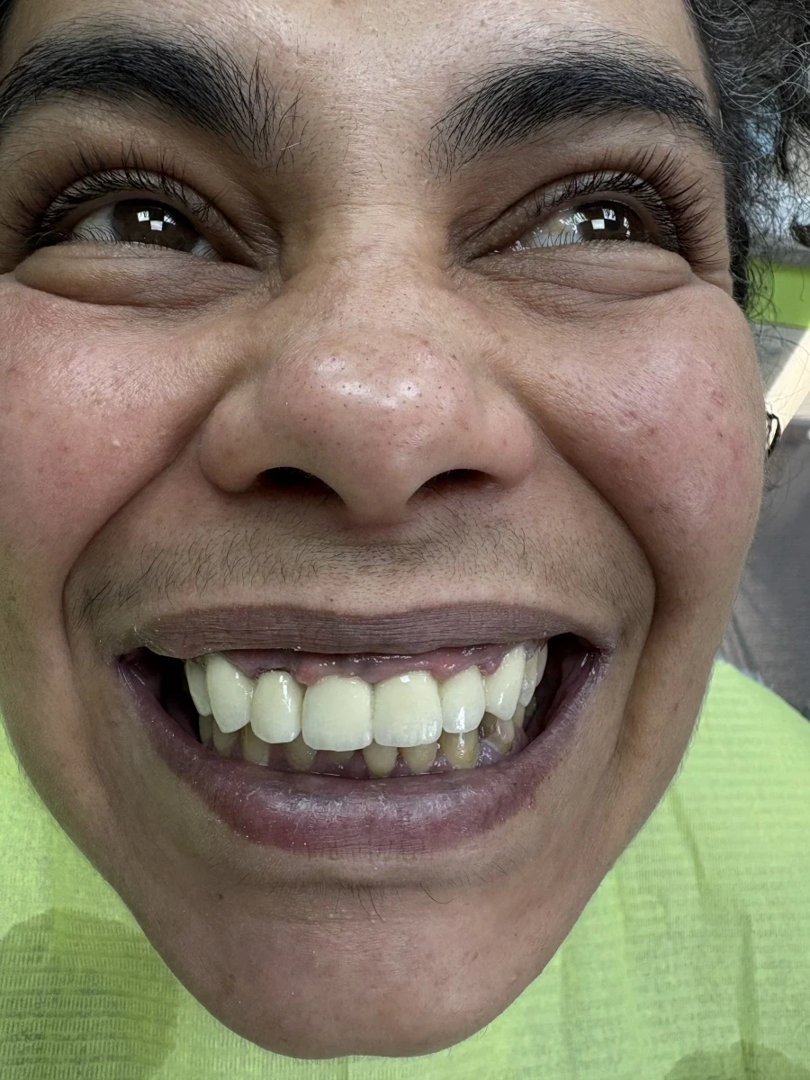 циментиране на корона/мост - Reservation.Studio циментиране на корона/мост - Reservation.Studio